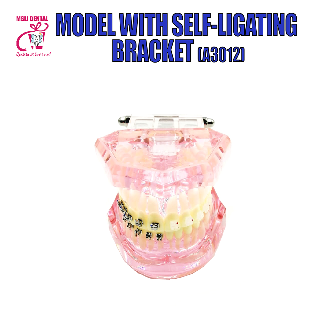 Model with Self-Ligating Bracket (A3012).png