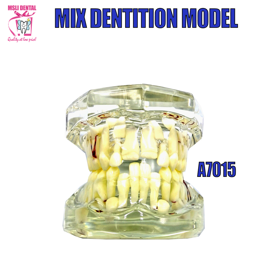 Mix Dentition Model.png
