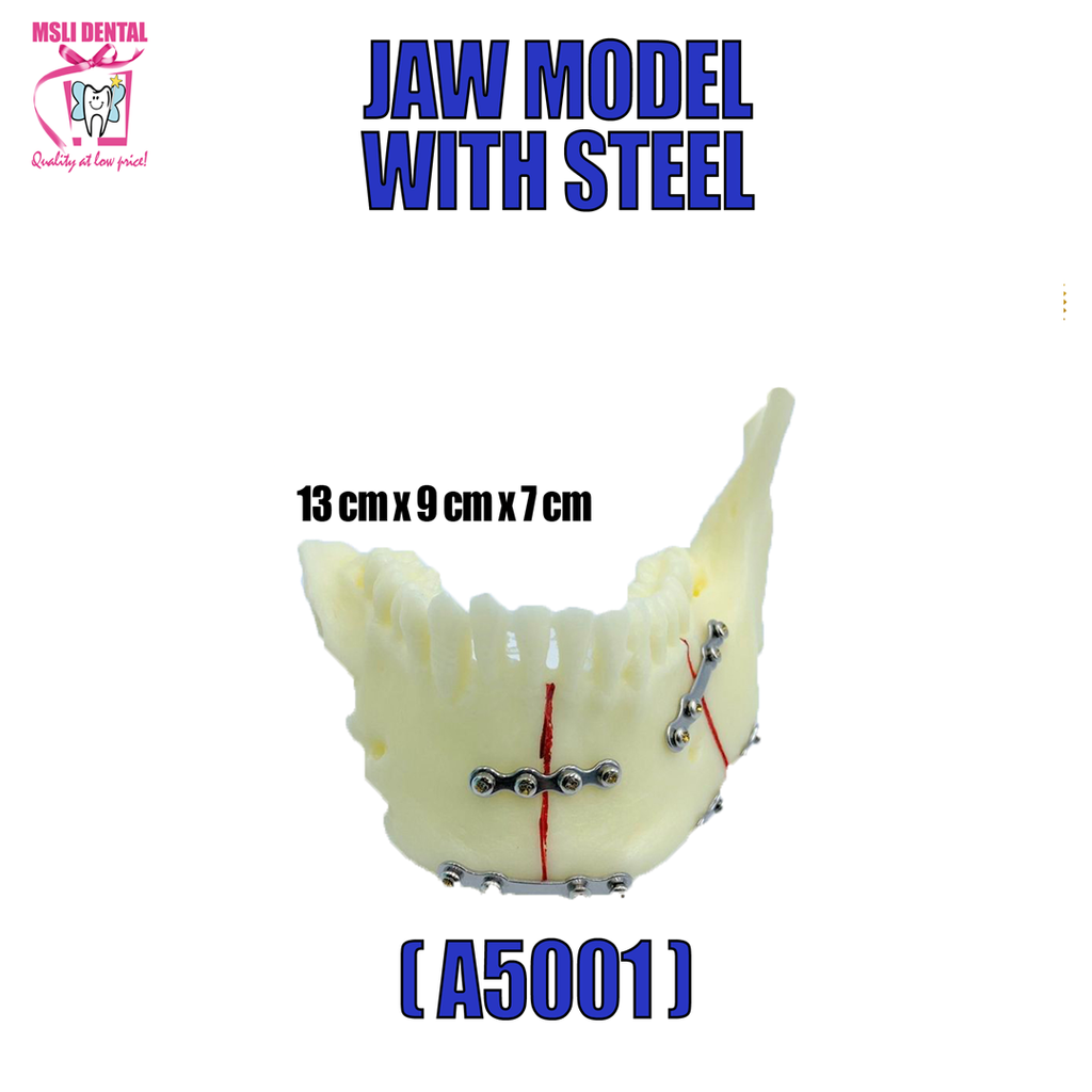Jaw Model With Steel.png