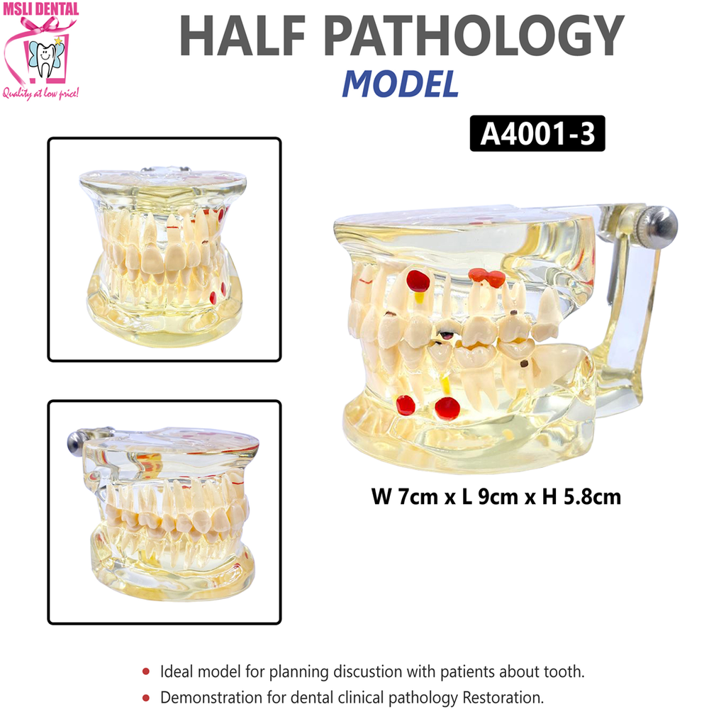Half Pathology Model.png