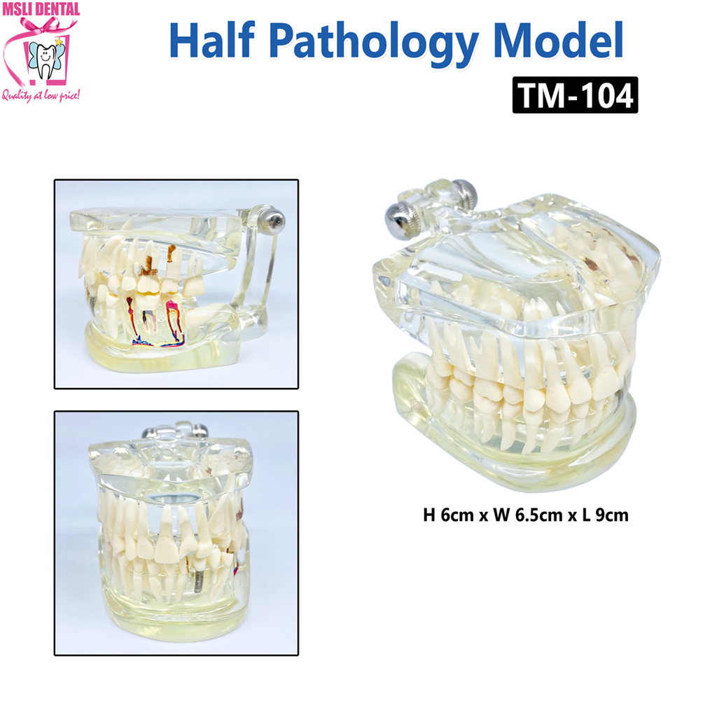 Half Pathology Model TM-104.png