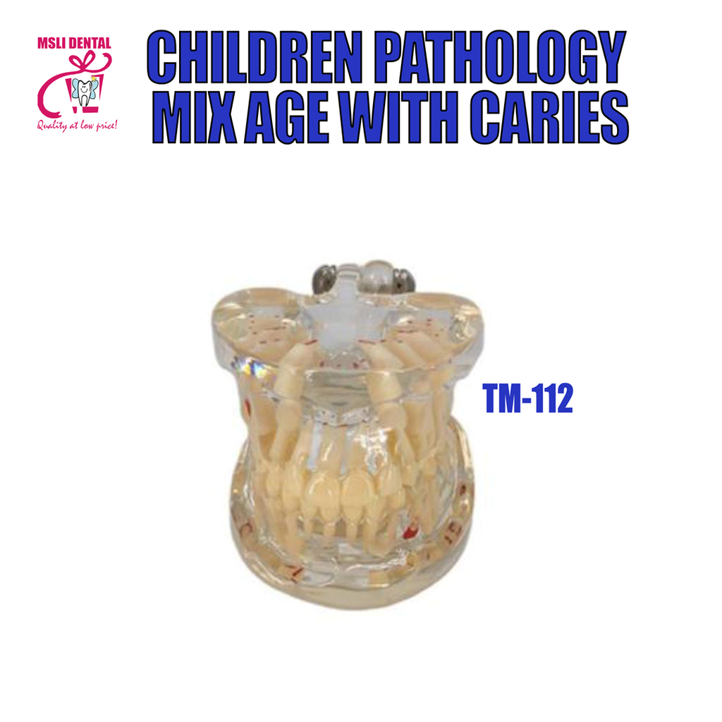 Children Pathology Mix Age With Caries.png