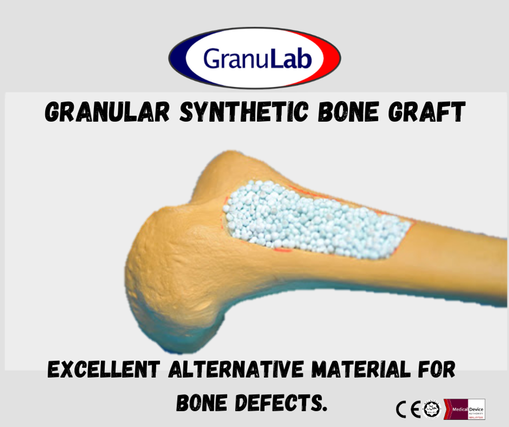 Granular Synthetic Bone Graft