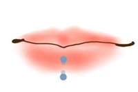 垂直穿唇Vertical labret piercing