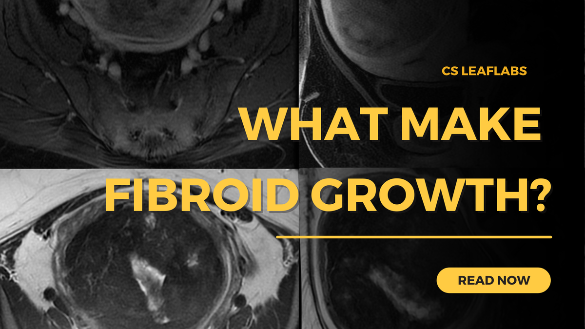What causes the growth of fibroid