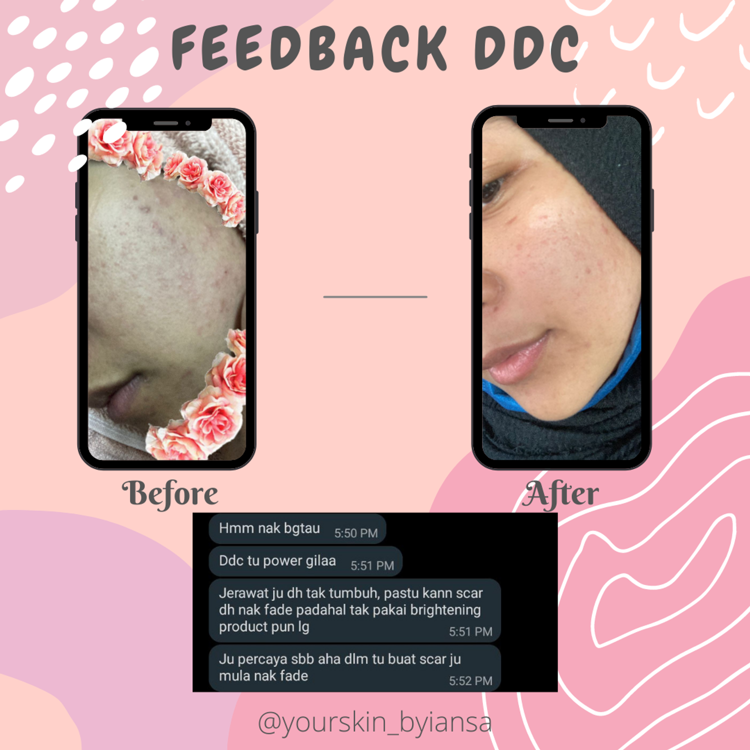 Yourskin_byiansa - Feedback DDC