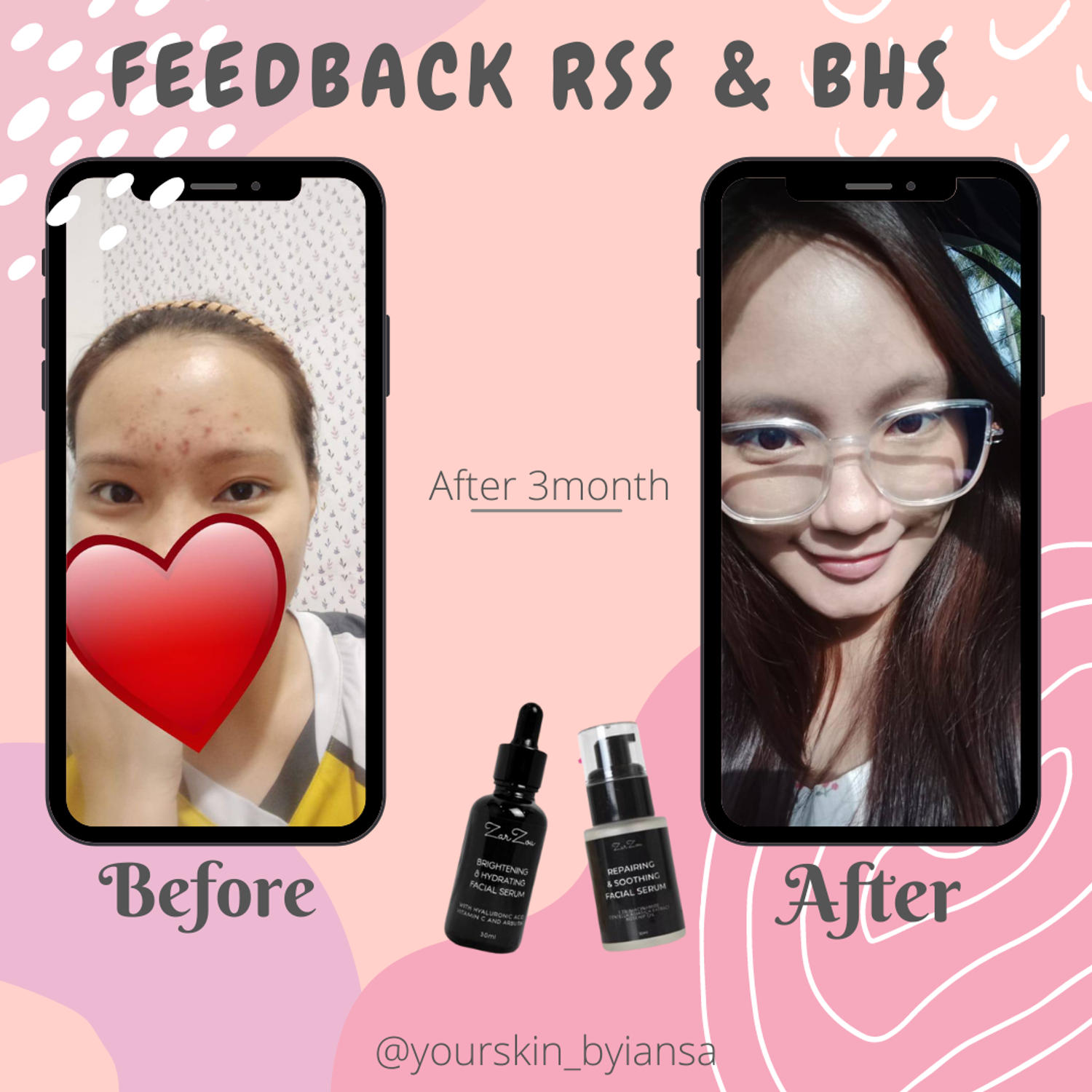 Yourskin_byiansa - Feedback RSS & BHS