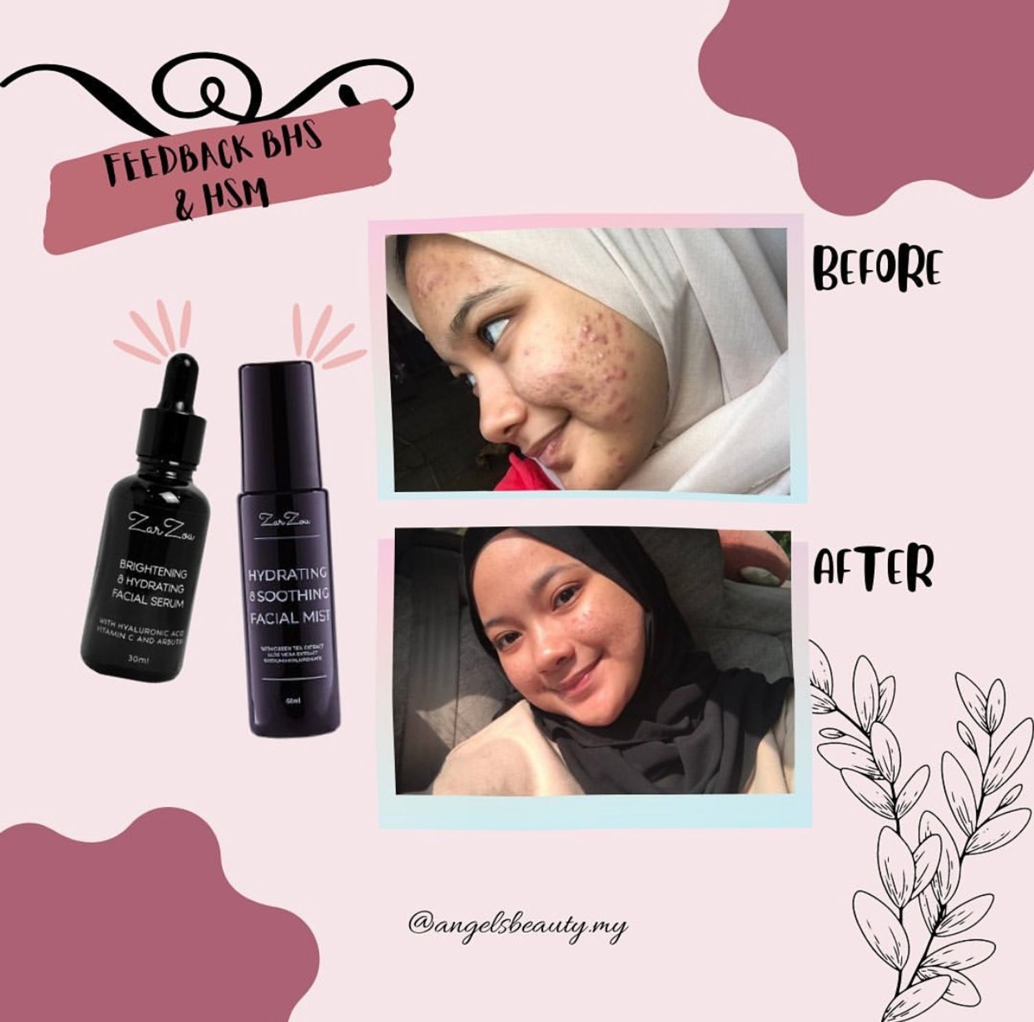 Yourskin_byiansa - Feedback BHS & HSM