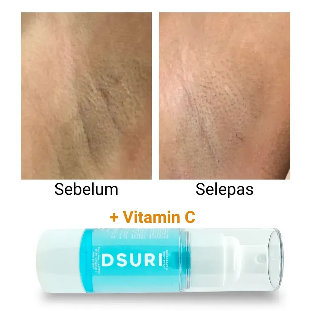 Gambar Ketiak Gelap VS Ketiak Cerah