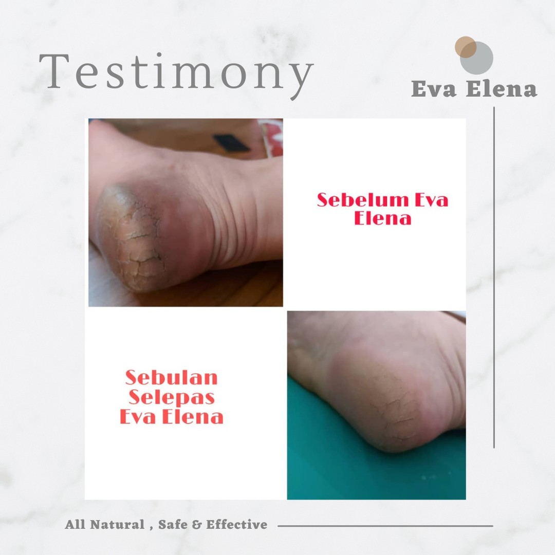 Eva Elena | TESTIMONIALS - Hard, Tough Cracked