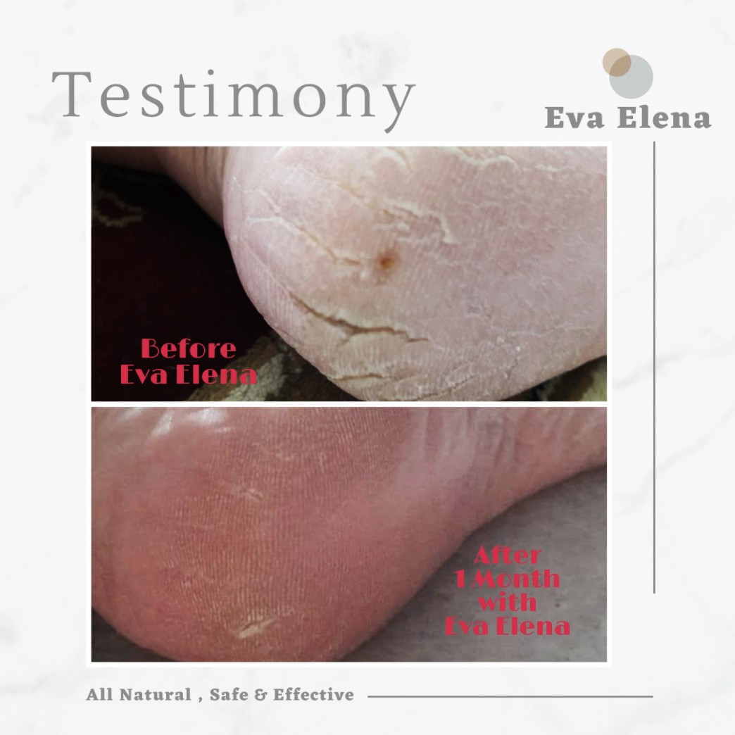 Eva Elena | TESTIMONIALS - Deep Cracked