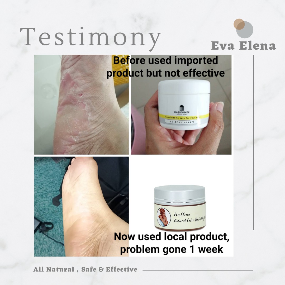 Eva Elena | TESTIMONIALS - Sensitive Skin