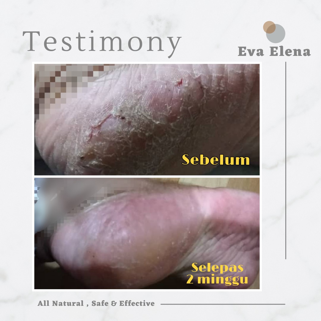 Eva Elena | TESTIMONIALS - Sensitive Skin