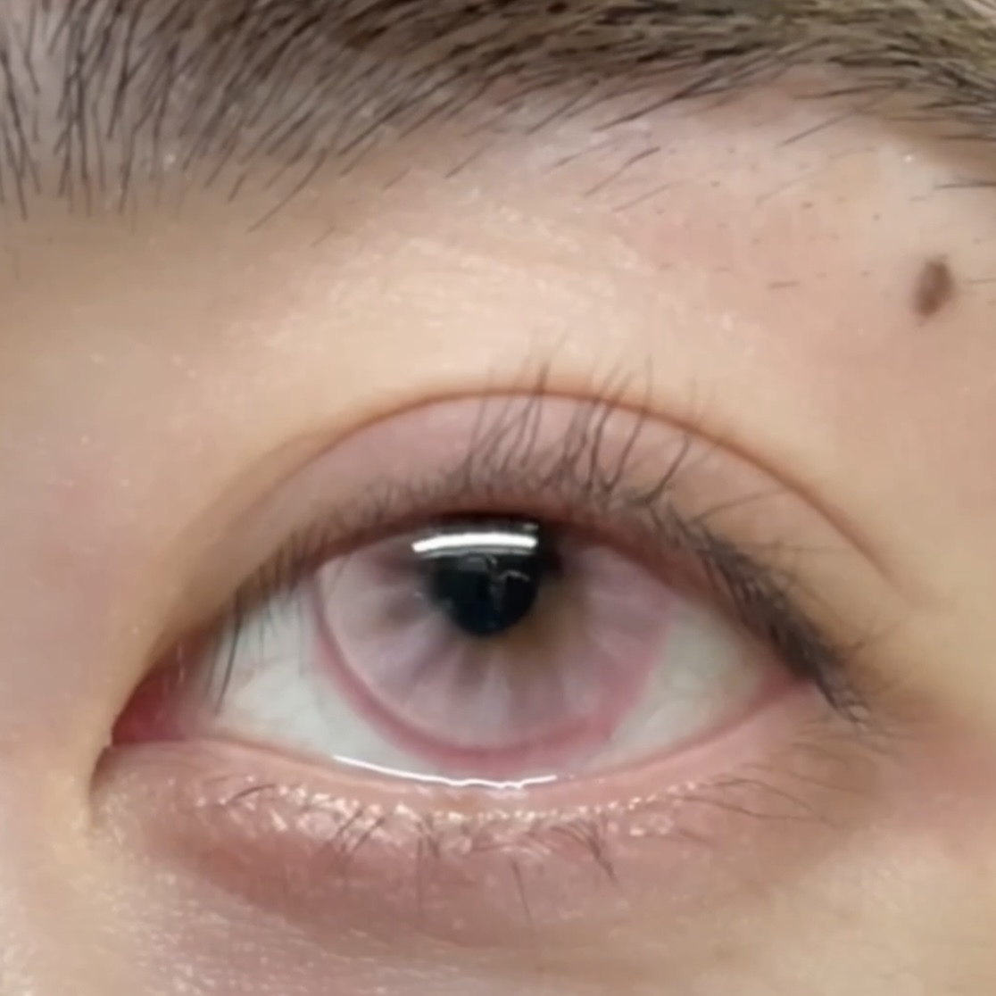 IMG_1584-1732861556122