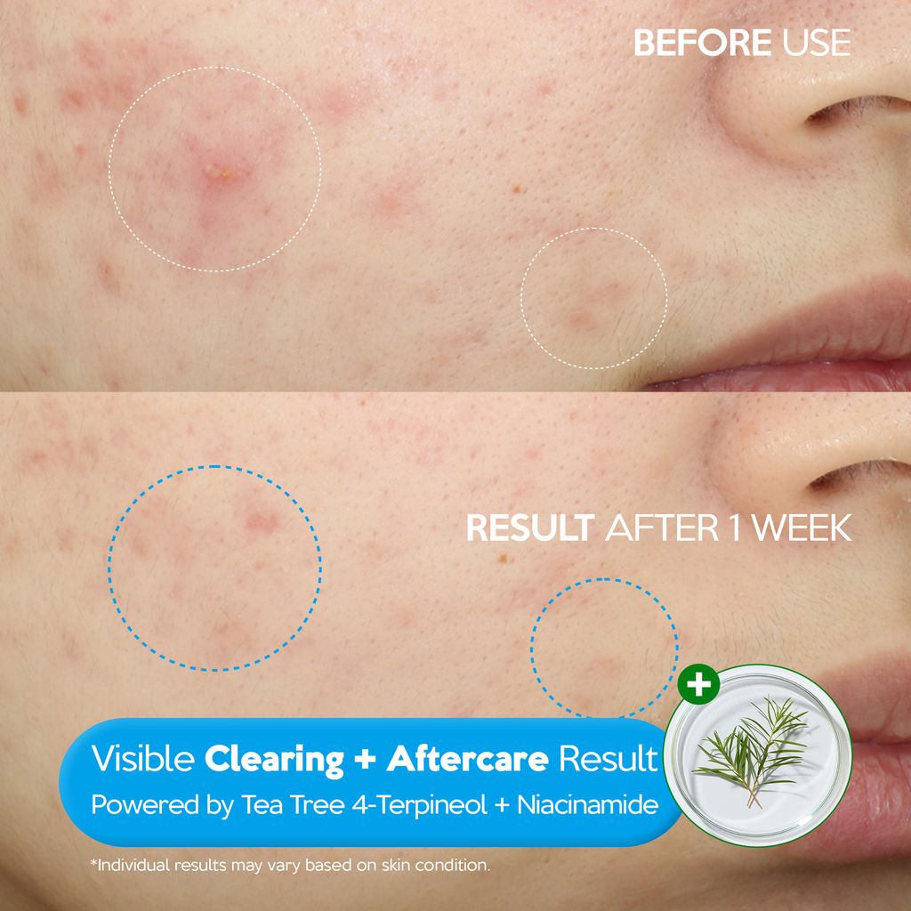 25_0526_clear_plus_barrier_booster_serum_thumb_claire_05