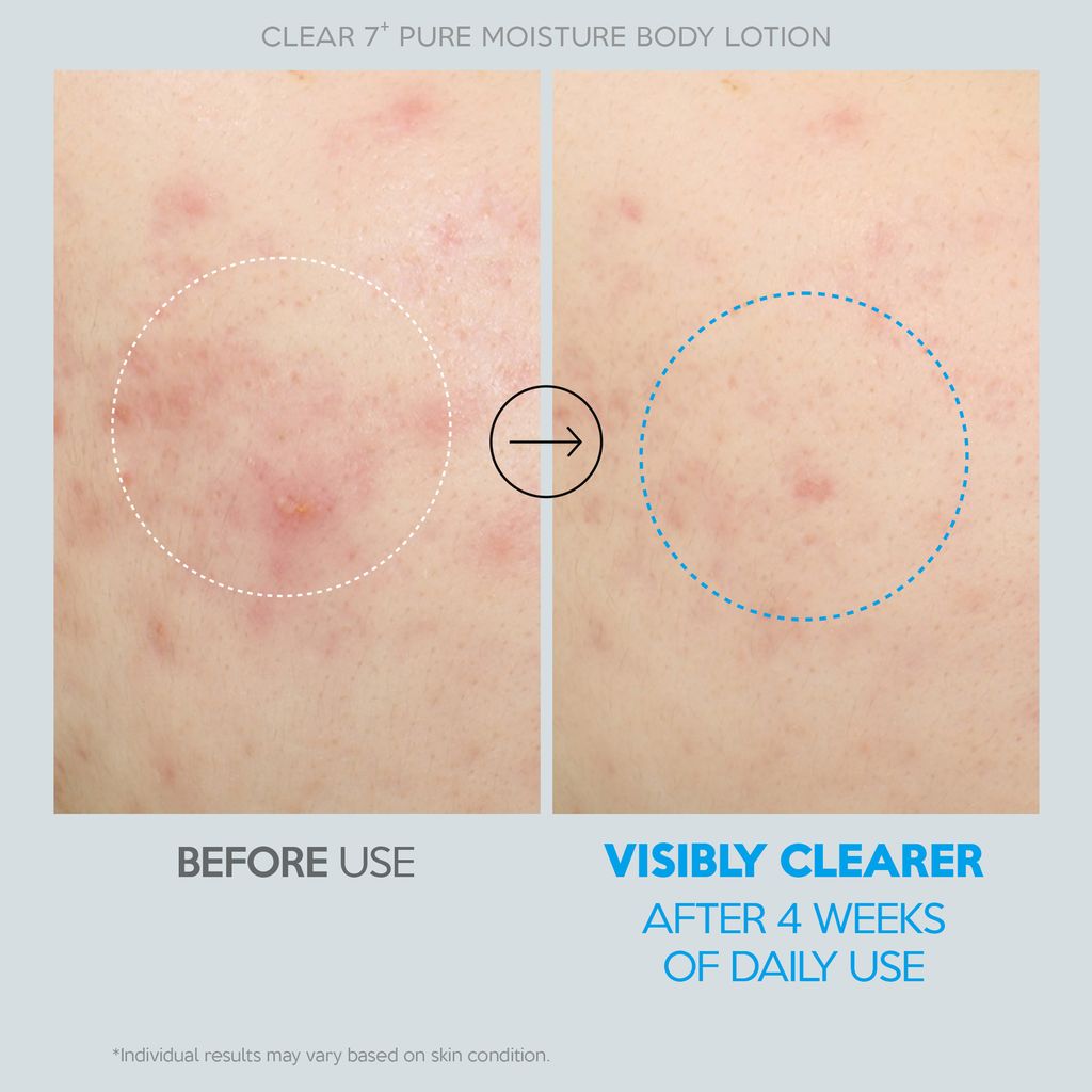 25_0616_clear_7_plus_pure_moisture_body_lotion_thumb_claire_04