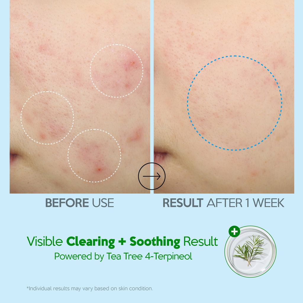 25_0602_hydro_soothing_moisture_cream_thumb_claire_05