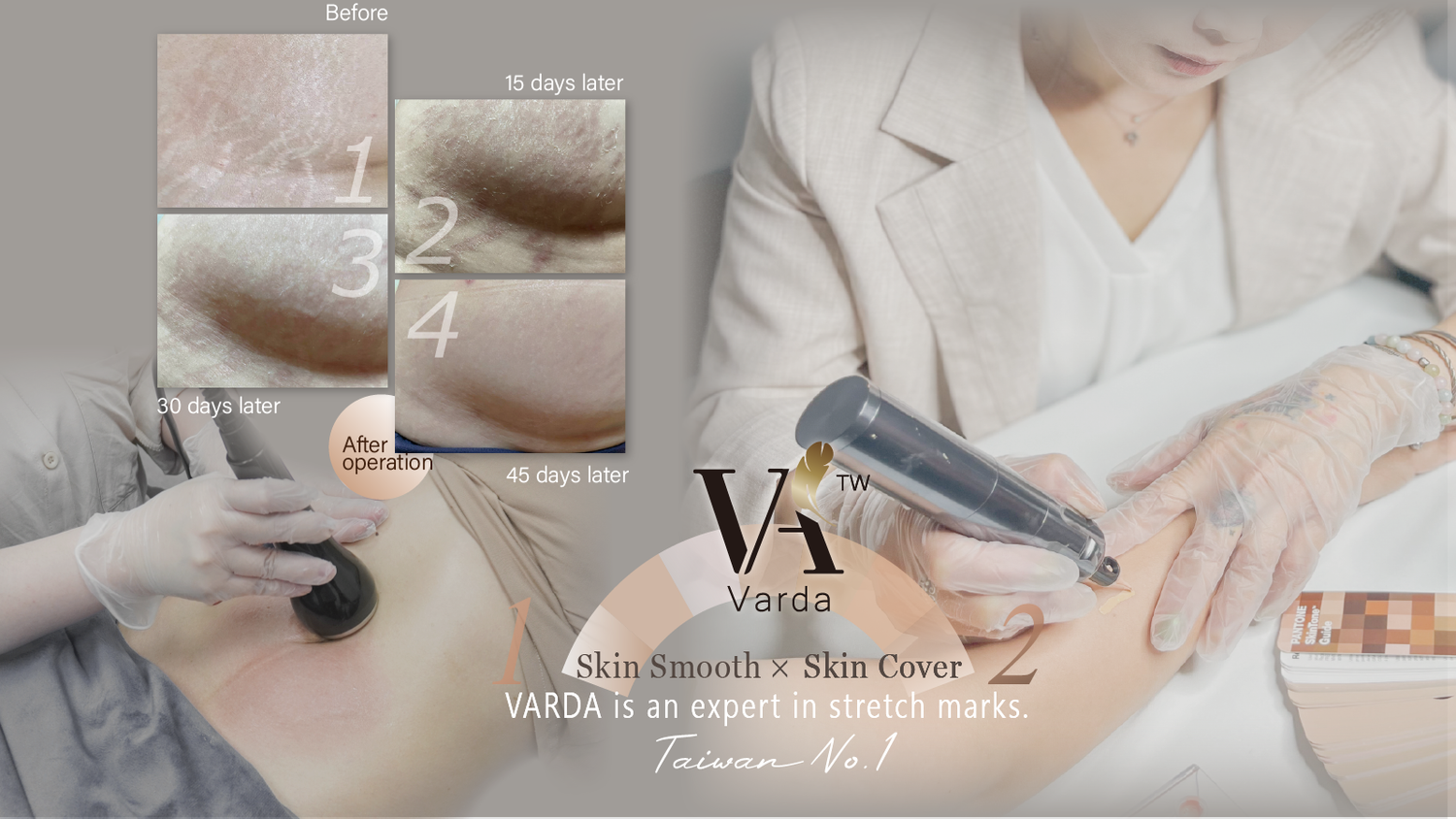 VARDA BEAUTY | 