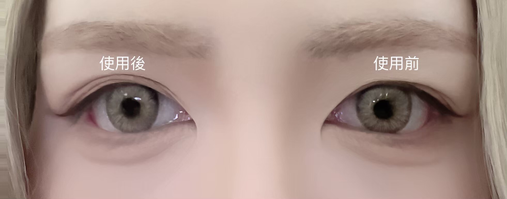 LINE_ALBUM_2024415_251108_2