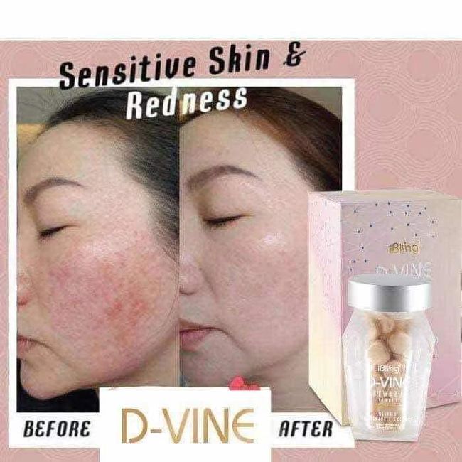 EMS ONLINE GLOBAL | PRODUCT TESTIMONY - D-VINE