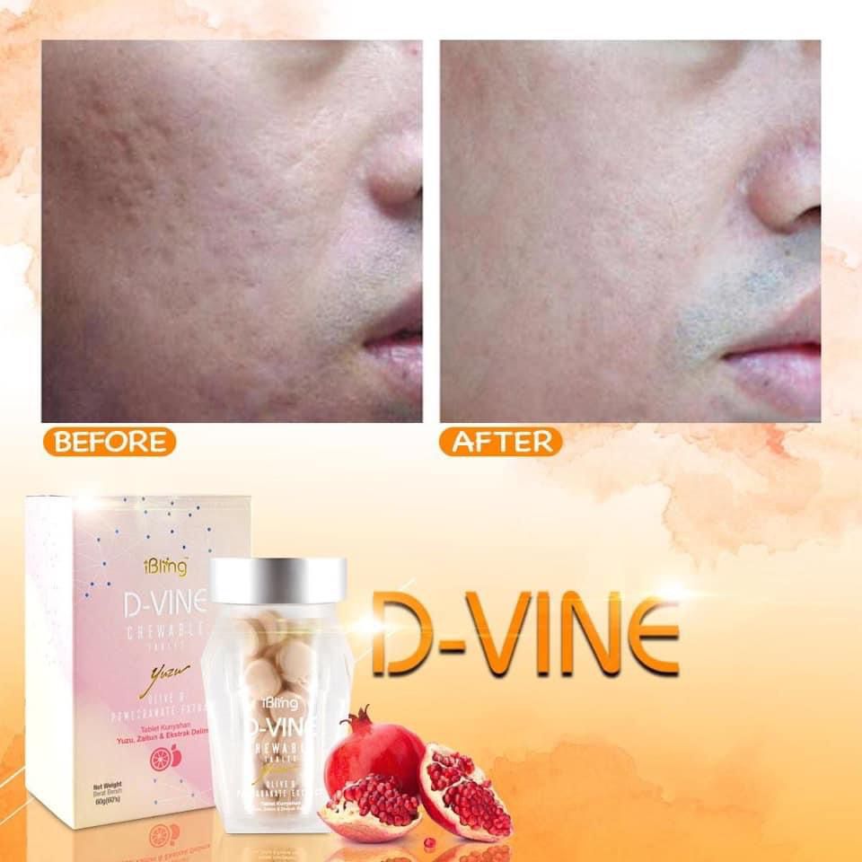 00e5c9eb-6d30-42b0-a237-aaea23e2eb74.jfif 00e5c9eb-6d30-42b0-a237-aaea23e2eb74.jfif