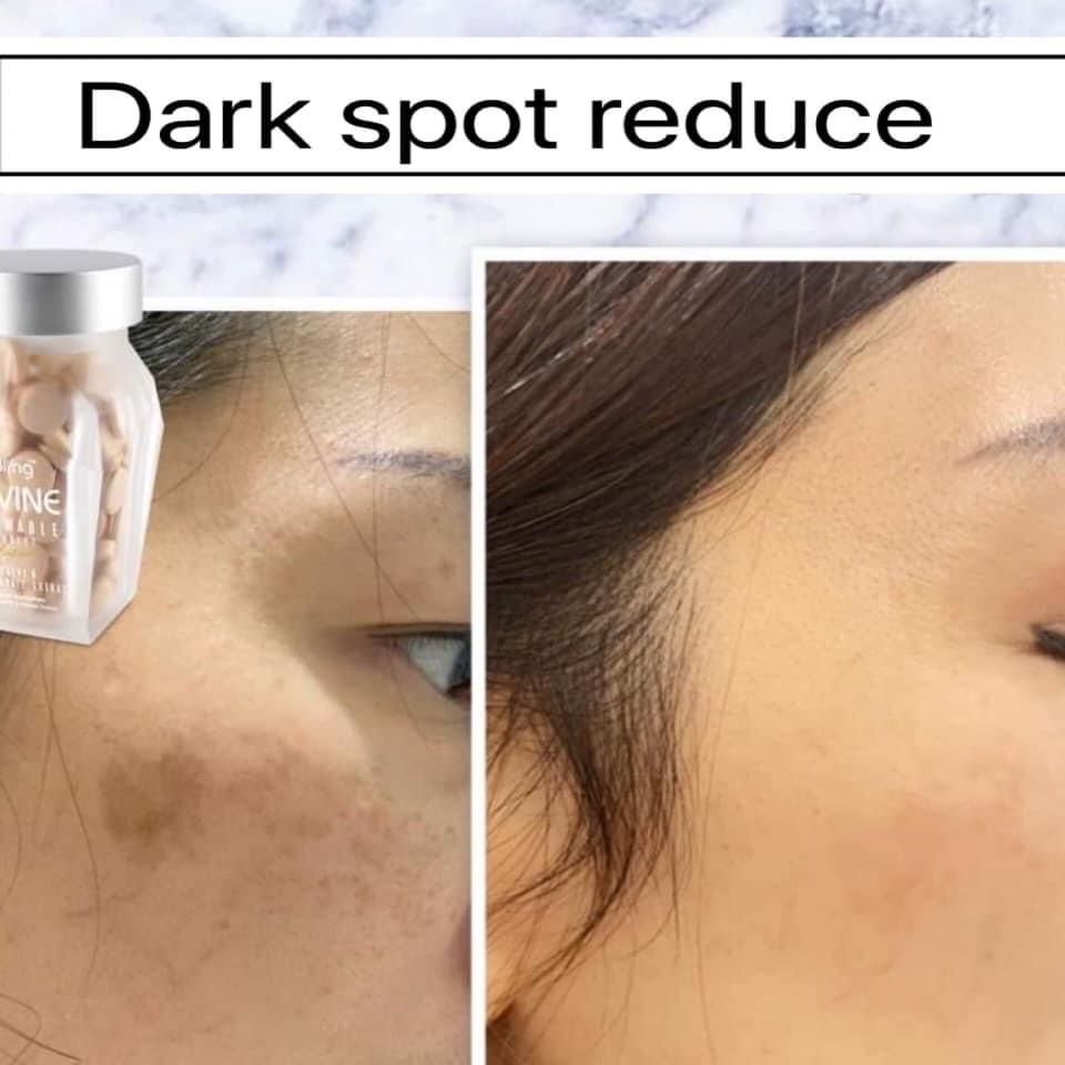 4226b845-1657-4a2d-9bc8-a714a0c0c150.jfif 4226b845-1657-4a2d-9bc8-a714a0c0c150.jfif