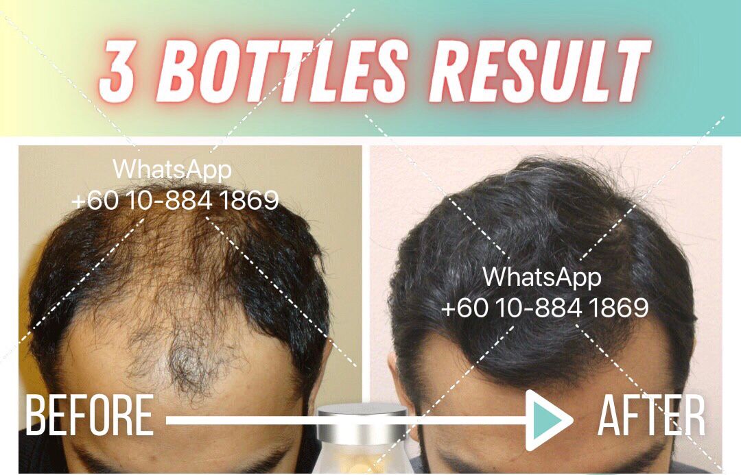 WhatsApp Image 2022-03-08 at 15.11.40 (1).jpeg