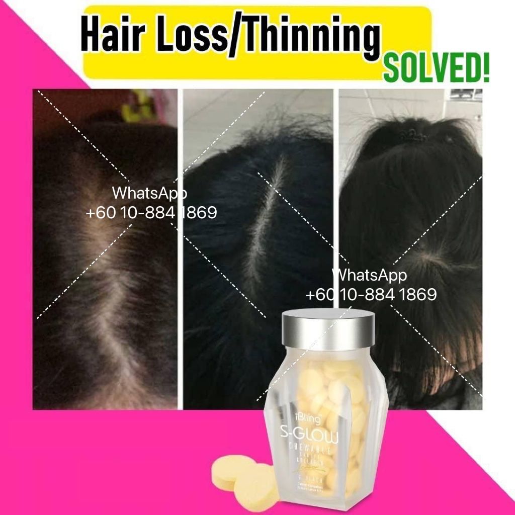 WhatsApp Image 2022-03-08 at 15.11.39.jpeg WhatsApp Image 2022-03-08 at 15.11.39.jpeg