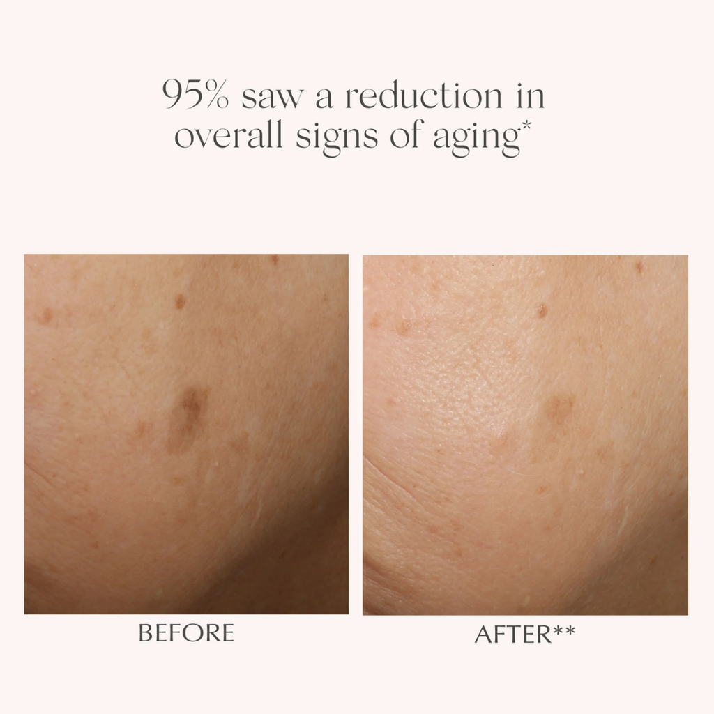 exuviance-renewal-retinol-serum-result