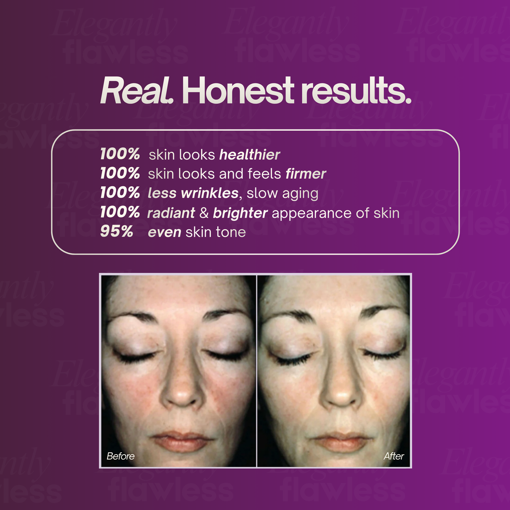 Exuviance_Overnight_Transformation_Complex_Results