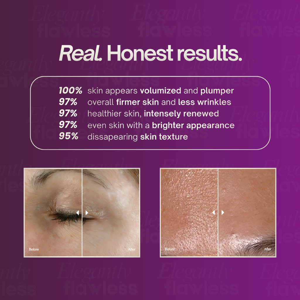 triple_microdermabrasion_results