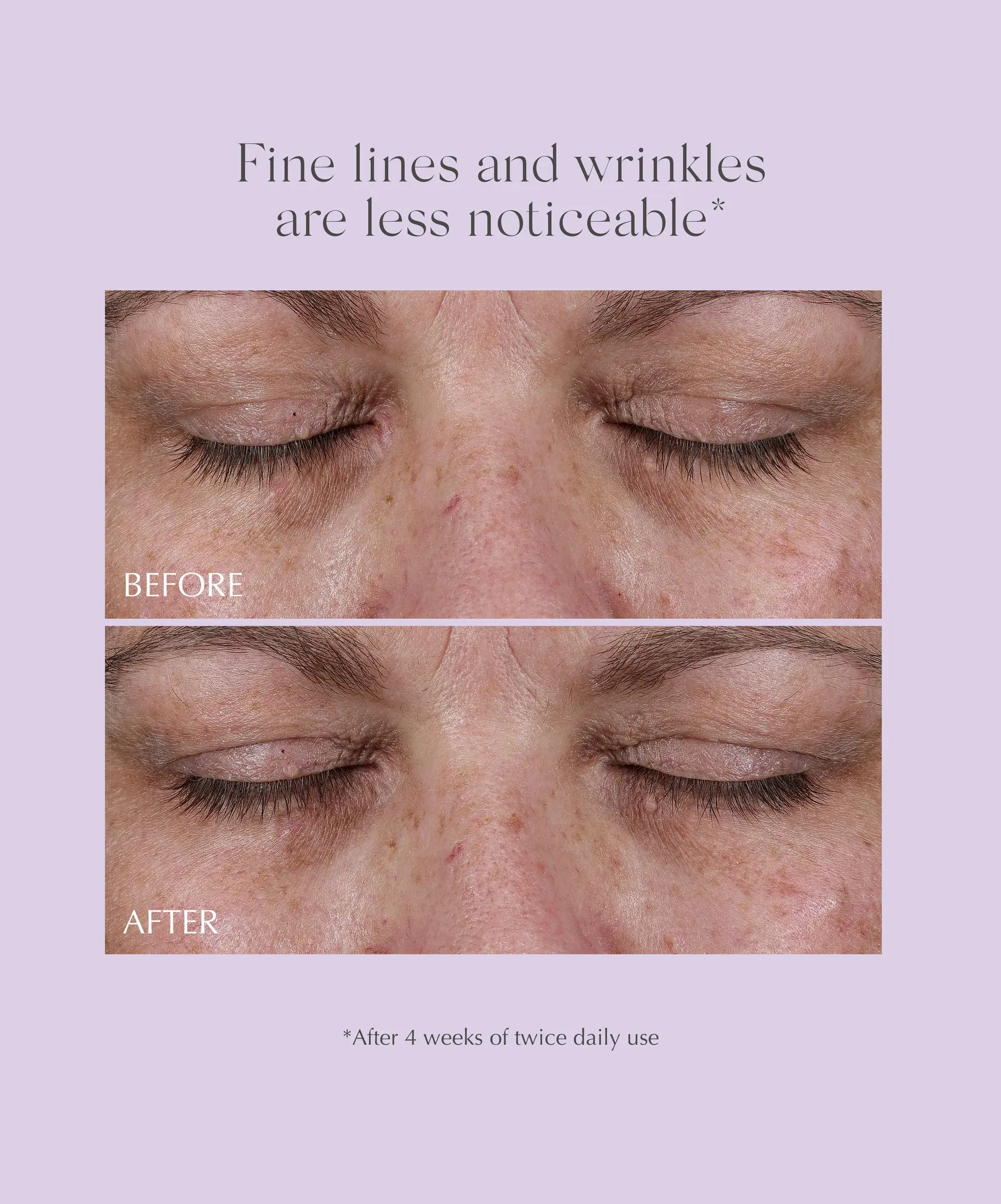 total-eye-contour-results