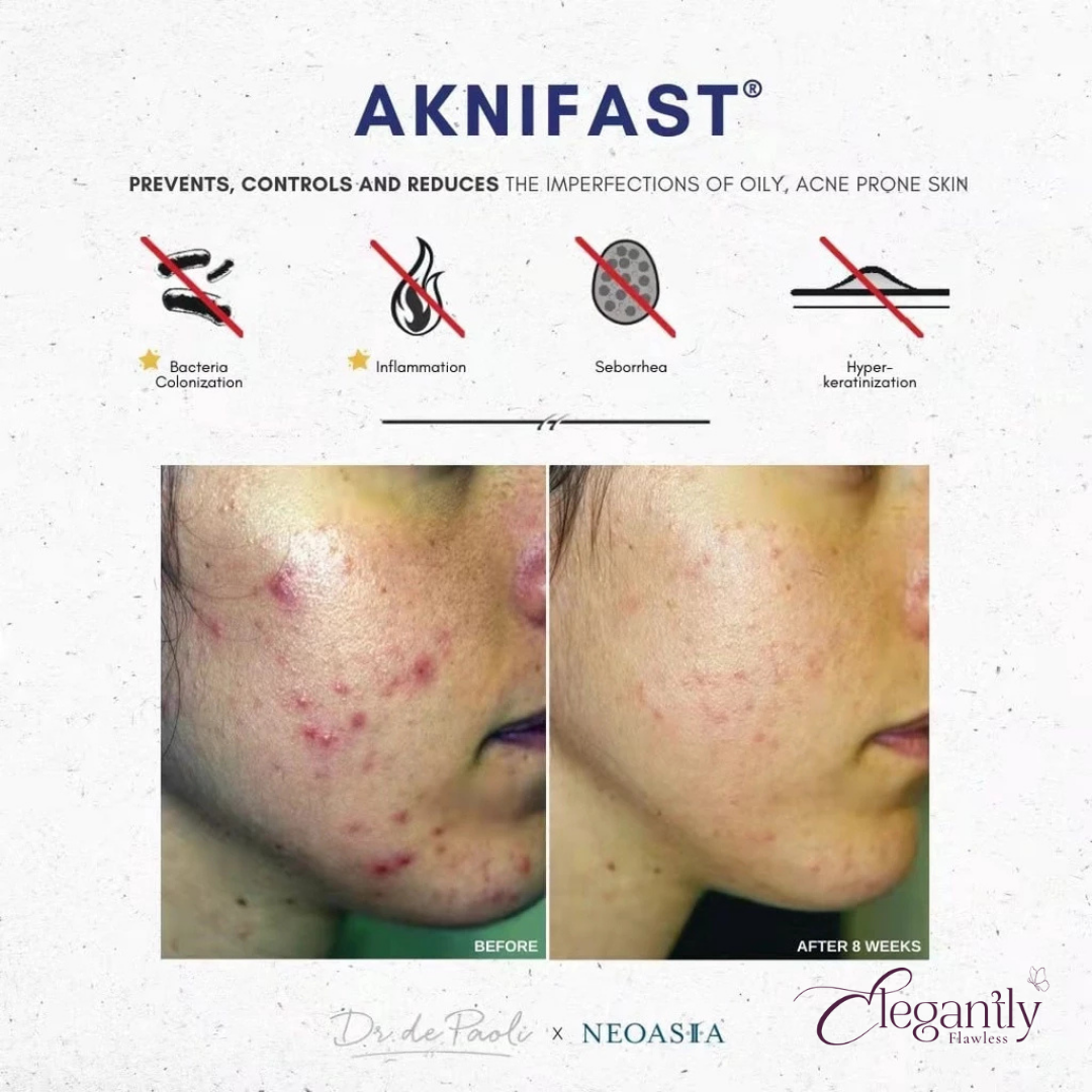 dr.depool x neoasia aknifast improvement