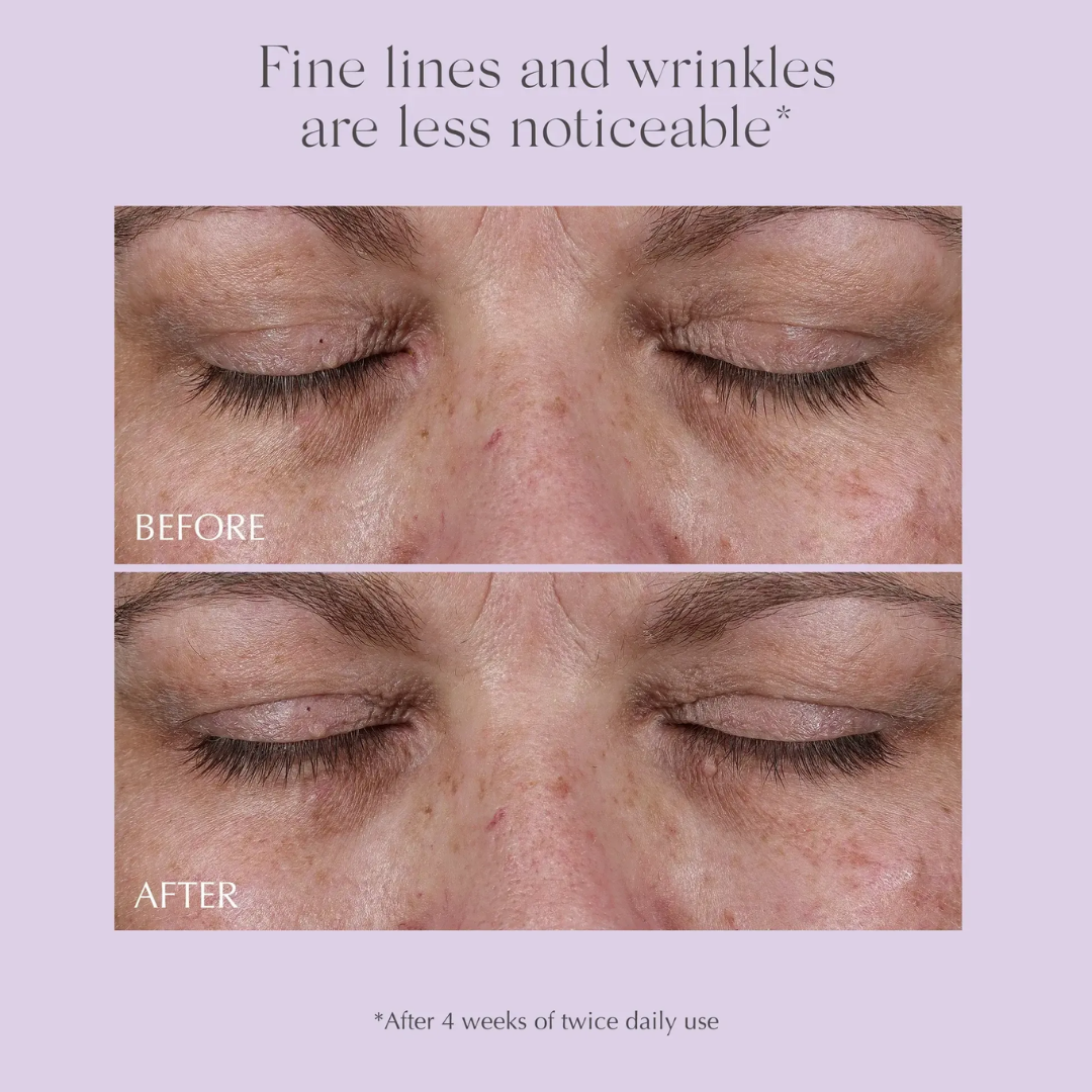 fine-lines-remover-age-reverse