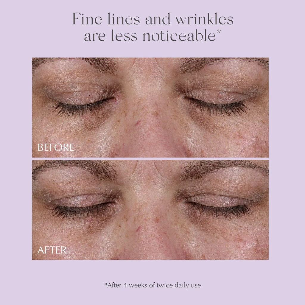 fine-lines-remover-age-reverse