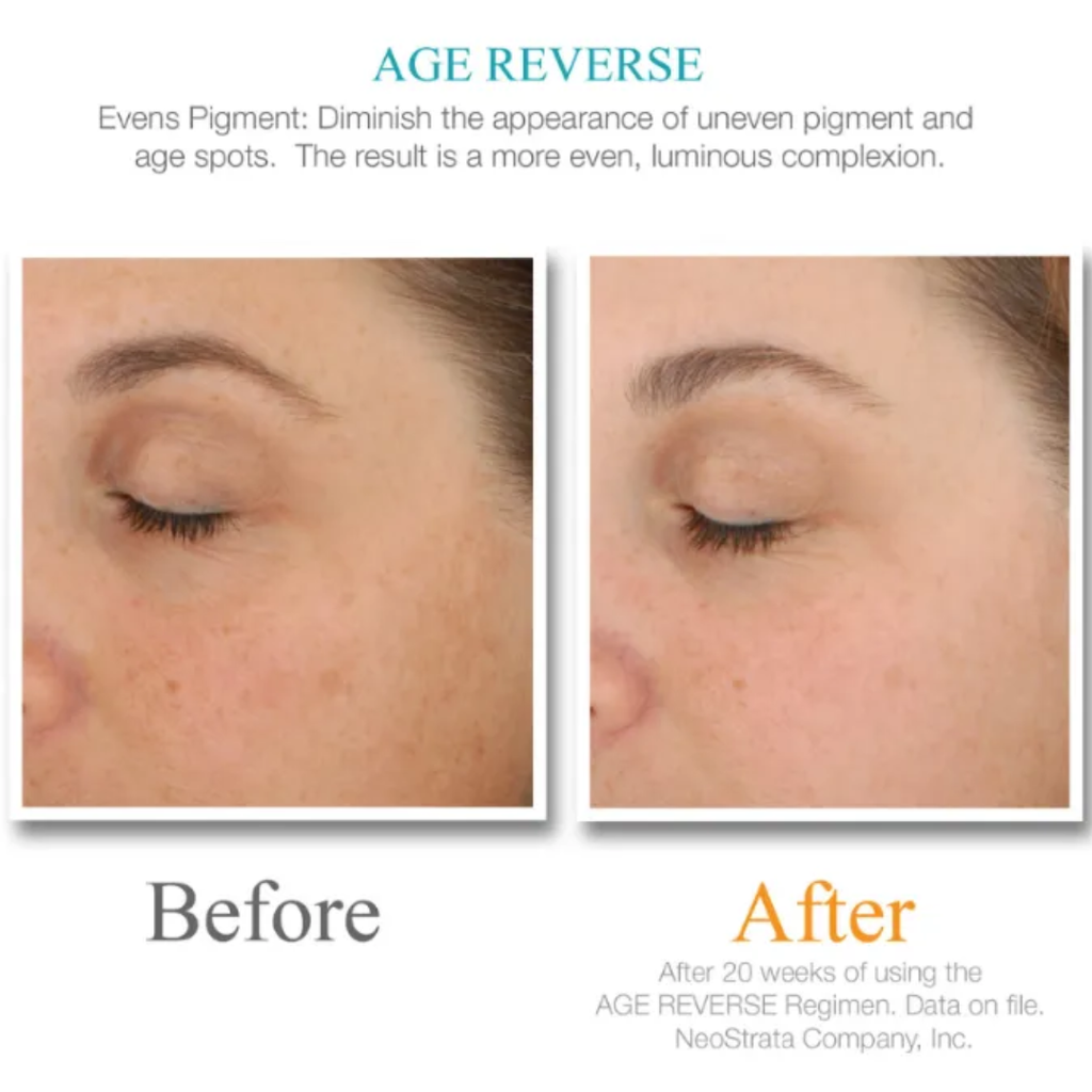 age-reverse-evens-pigment