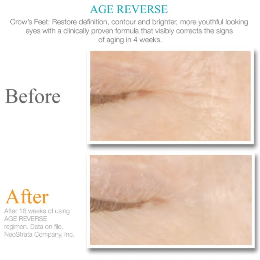 age-reverse-wrinkles