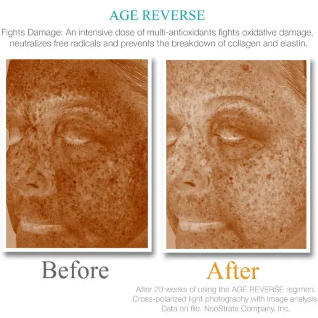 age-reverse-fights-damage