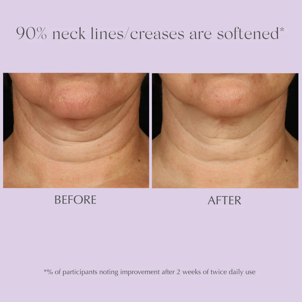 exuviance-age-reverse+-advanced-toning-neck-cream-125g-before-&-after