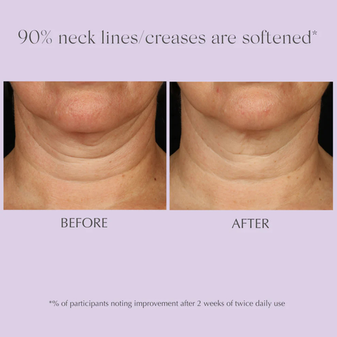 exuviance-age-reverse+-advanced-toning-neck-cream-125g-before-&-after