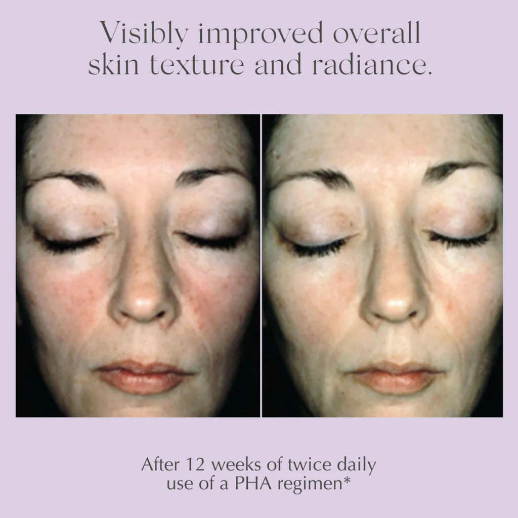 exuviance-overnight-transformation-complex-50g-before&after