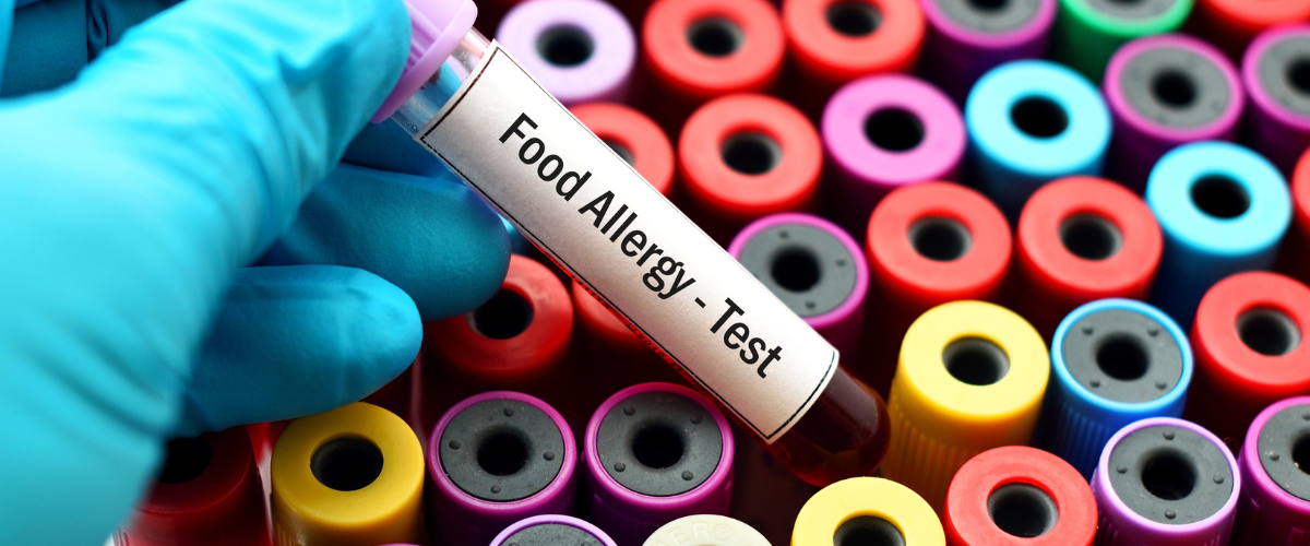 Ezcema in Children Part 2: Food Allergy Test