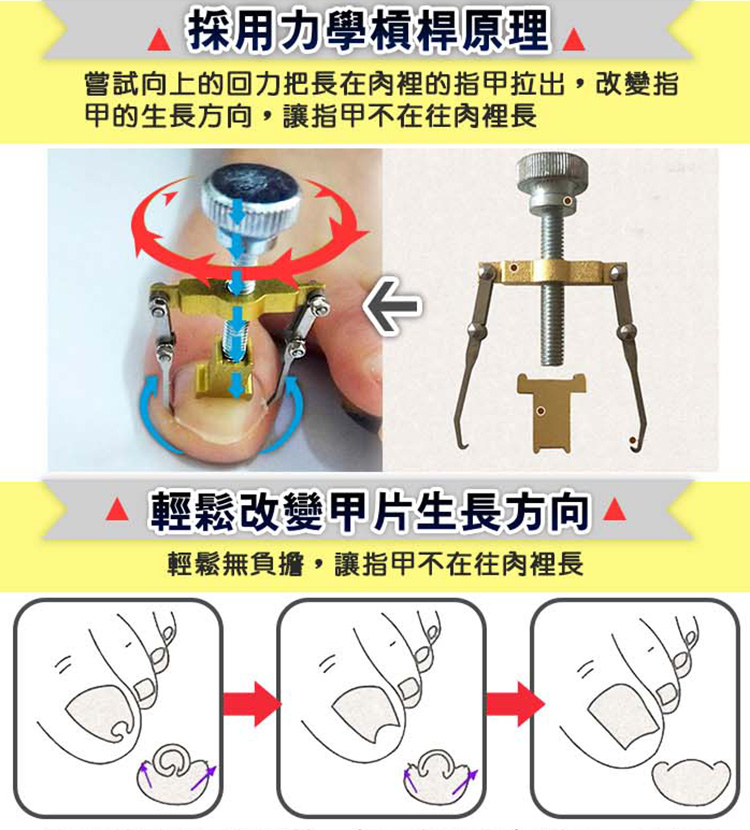 Magicsport官網_全網獨賣_修護足痛專區_JG-034_主圖06.jpg