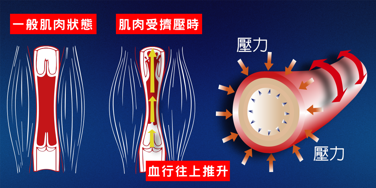 Magicsport官網_運動SPORT_運動機能腿套_貼紮阿基里斯腱運動腿套_JG-291_主圖03