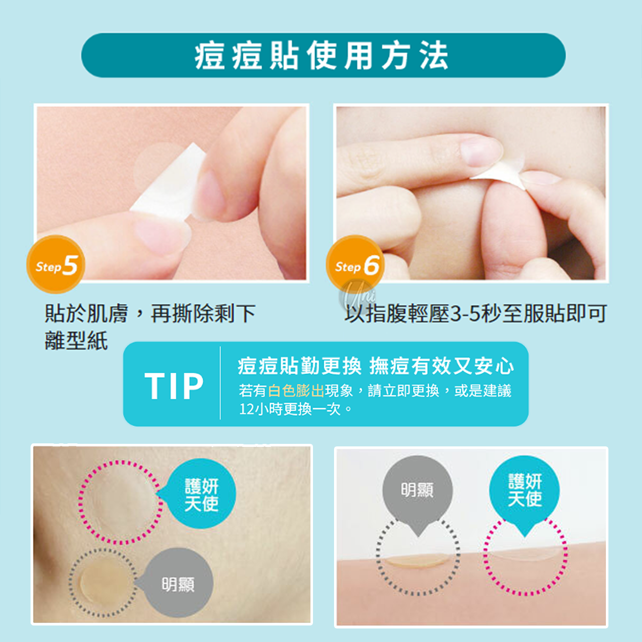 universomart護妍天使授權素材痘痘貼使用方法dermaAngel-Acne-Patch-use-2 ICON