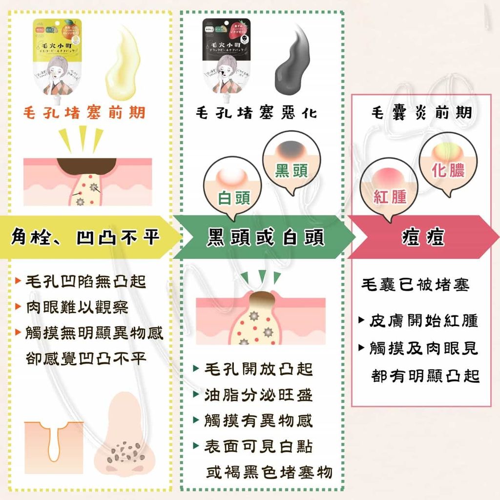 2_universomart宇碩協銷_日本毛穴小町積雪草添加剝除式面膜_KOSE-keanakomachi-peeloff-mask LOGO