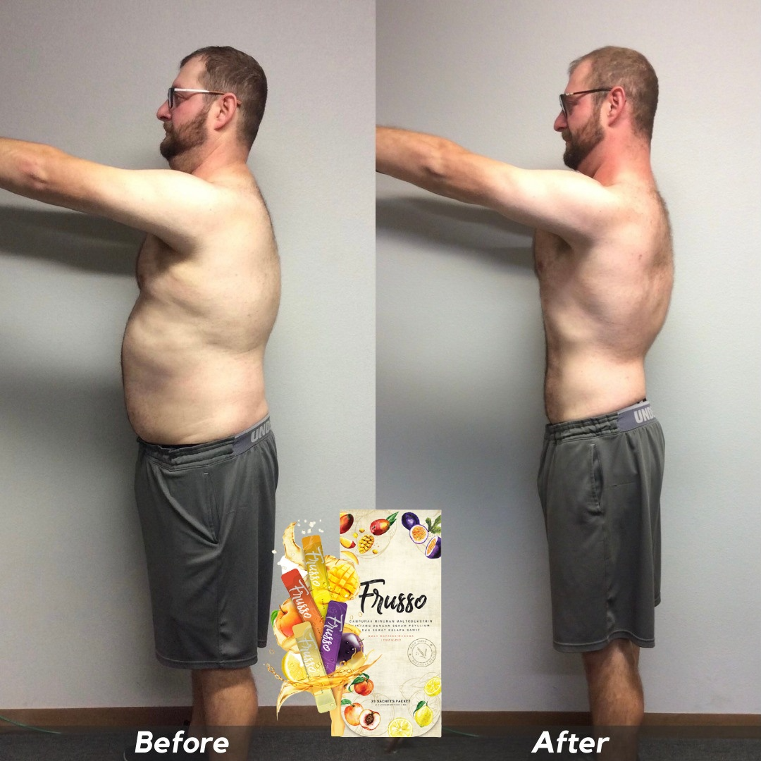 Omalza-Before_After-Jason-Isaac-3F.jpg