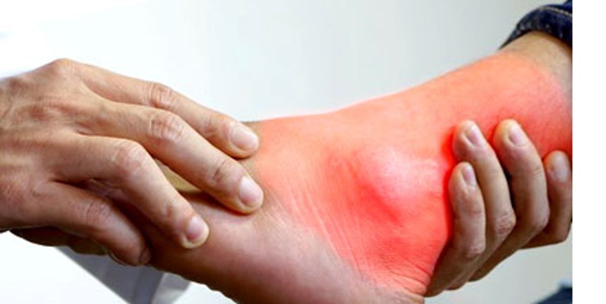 Kajian -‘People with Gout at Risk of Premature Death’