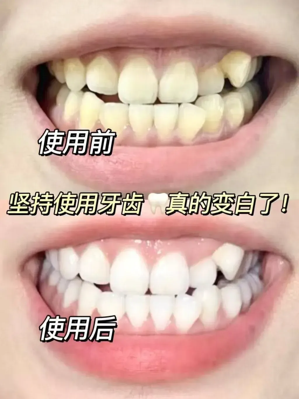92040355