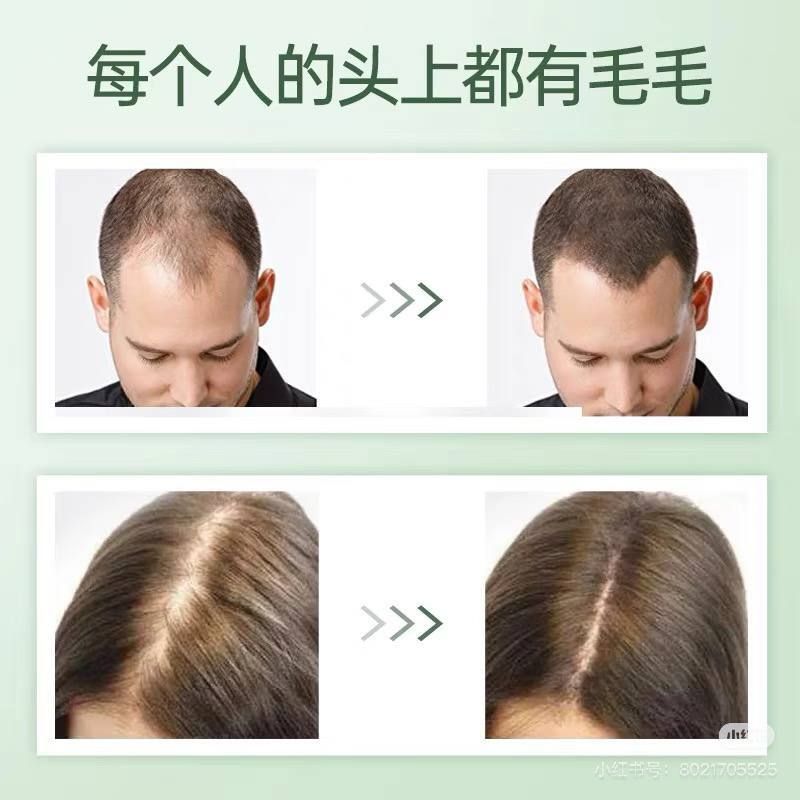7d33f60b-32ce-4f30-8629-1534d586050e